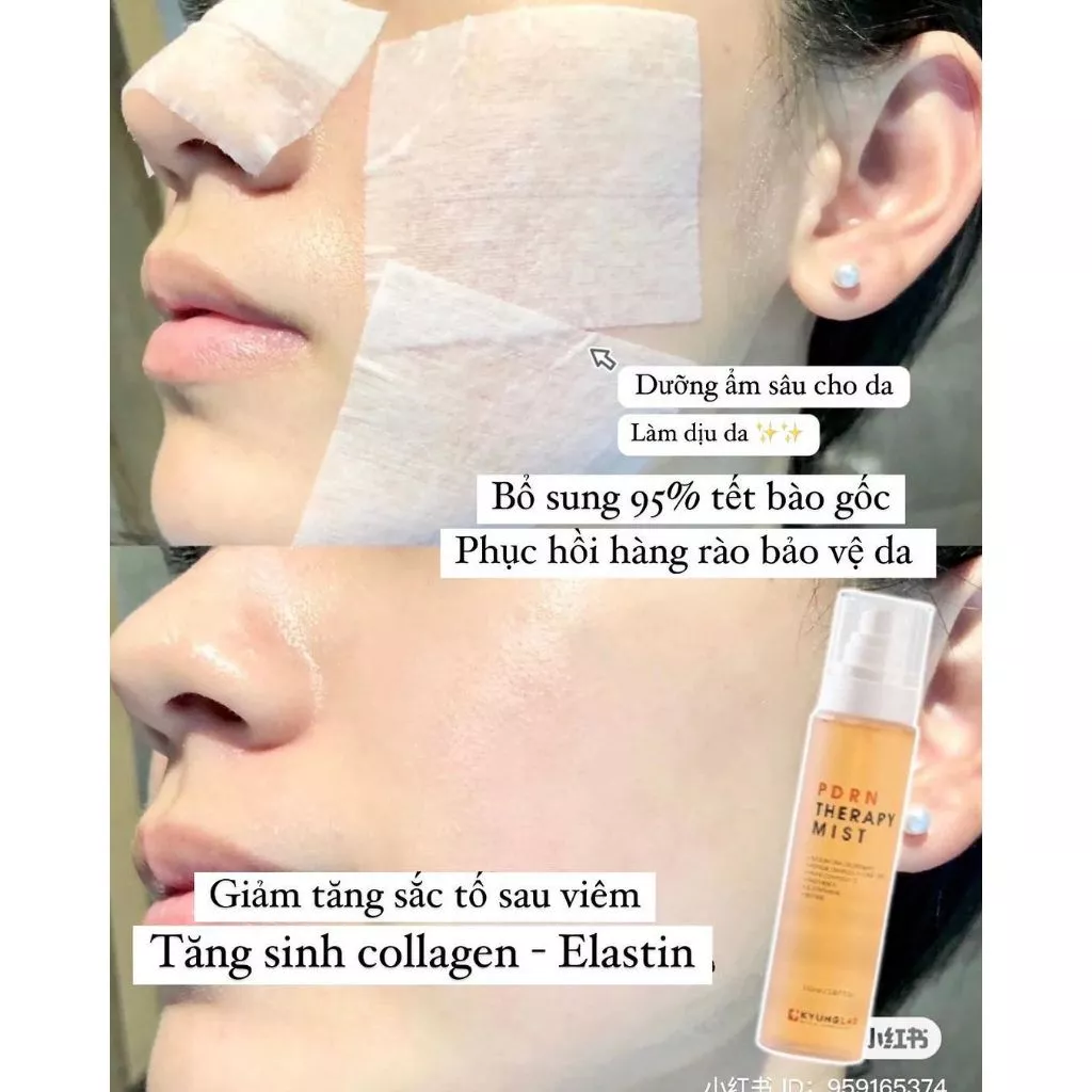 Xịt khoáng KyungLab Pdrn Mist chống lão hoá tái tạo - Hình ảnh 8